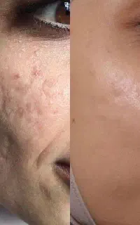 دمودکس