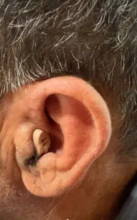 کلینیک شنوایی و سمعک شیراز/ اقساط/تعمیرات/ بیمه
