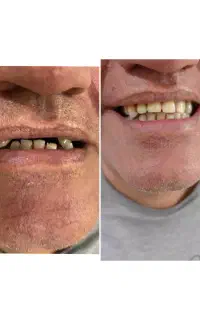 دندان