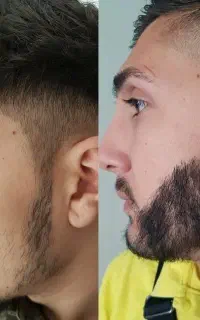 30 روزه ریشات رو پرپشت کن