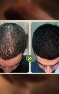 موهات و دوباره درمیاره
