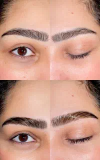 لیفت ابرو و مژه