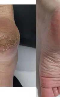 پدیکور کفسابی اسپا