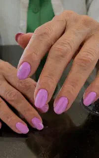 تخفیف ویژه. به ازای هر یک کاشت ژلیش پا رایگان