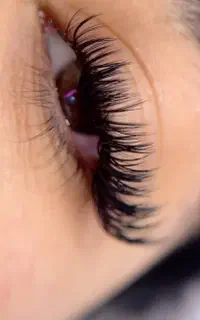 کاشت مژه