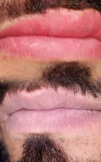 رفع کبودی و بیرنگی لب ها