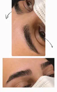 اصلاح با شمع صورت
