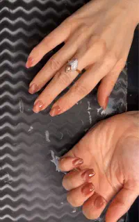 کاشت ناخن