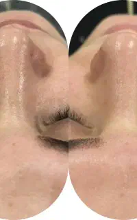 فیشیال،آبرسانی،ماساژ فقط با ۵۰۰ تومان