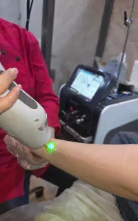 لیزر ویژه تابستان