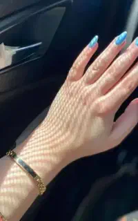معجزه سفیدی دست و پا صورت