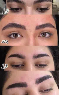 میکروبلیدینگ