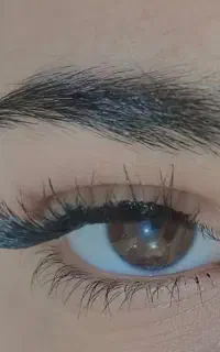 کاشت مژه
