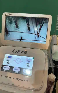 آموزش اسکراب اسکالپ مو تخفیف
