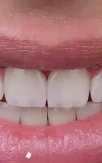 دستیار حرفه ای دندانپزشکی