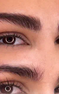 میکروبلیدینگ فیبروز خط چشم خط لب شیدینگ لب تاتو