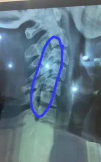 حجامت ماساژ زالو فصد بادکش دیسک سیاتیک دررفتگی زرد