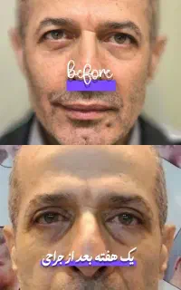 خدمات پوست مو زیبایی دکتر تدین زاده
