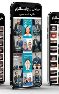 تولید محتوا در اهواز (بدون نیاز به ادمین)