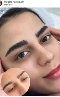 تخفیف ویژه فیبروز.میکرو.شیدینگ.خط چشم.