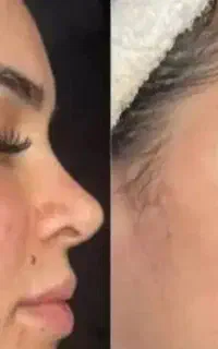 اموزش تخصصی استخدام فشیال وپاکسازی
