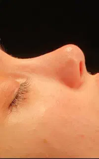جراحی بینی و اندام