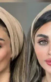 کلینیک تخصصی فرسیما/لیفت نخ/کانتورینگ/فیلر/بوتاکس