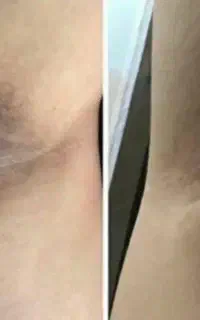 نمایندگی رسمی کرم تیرگی گاتیو