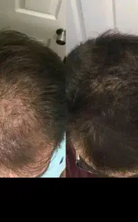 انقدر میمالی رو سرت تا دربیاد