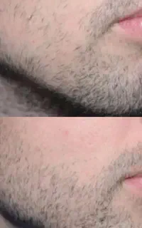 ریش طبیعی استایل مردونه