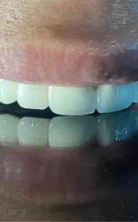 لابراتوار دندانسازی