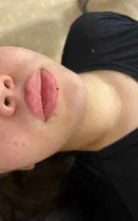فیلر و‌بوتاکس ،رنگ مو تخصصی ،میکروبلیدینگ