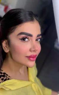 تزریق ژل لب کرج جشنواره لب روسی فیلر بوتاکس لیزر