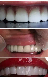 خدمات دندانپزشکی  و دندانسازی مستر دنت (اقساط)