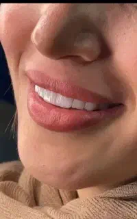 وام 4درصدی برای خدمات دندان پزشکی