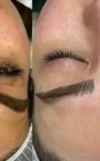 پاکسازی فیشال درما تخصصی فقط ۳۰۰ کجا به این قیمت