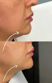 جوانسازی/کاهش علائم پیری/توسط پزشک