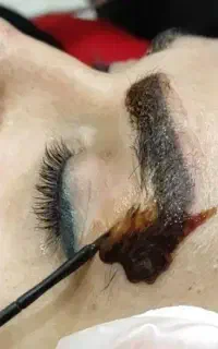 ریمووتخصصی رژوی در ابادان و آرایش دائم