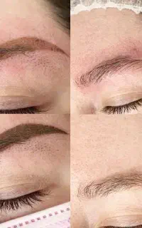 اموزش تخصصی ریموو