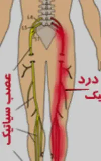 مرکز تخصصی ماساژ و حجامت در سنندج