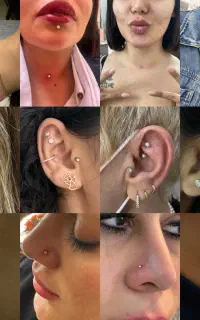 فیلر و بوتاکس و مزوتراپی و پیرسینگ و میکرودرمال