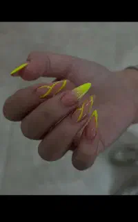 کاشت ناخن