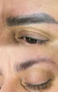 پاک کردن ریموو تتو های قدیمی صورت با مواد.بدون درد