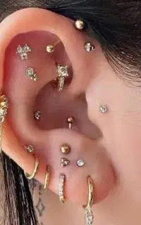 جراحی سرپایی سوراخ گوش خال چربی زگیل کیست چال گونه