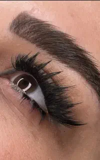 کاشت هیدن(موقت)باکمترین هزینه
