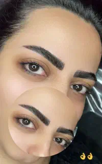 خدمات، فیبروز، میکروبلیدینگ،قاب و سایه ،شیدینگ