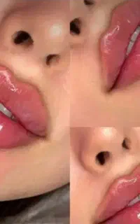 فول فیس،زاویه آقایان،ژل،بوتاکس زیربغل،فیلربادی