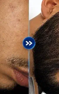 یکماهه پرپشتش کن