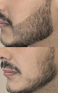 بدون ریش بیا با ریش برو