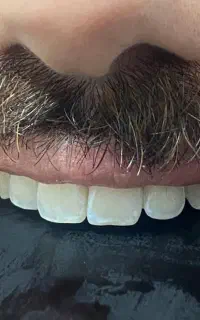خدمات دندان پزشکی با بیمه تکمیلی و اقساطی